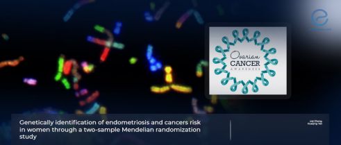 Endometriosis and Ovarian Cancer: A Genetic Connection