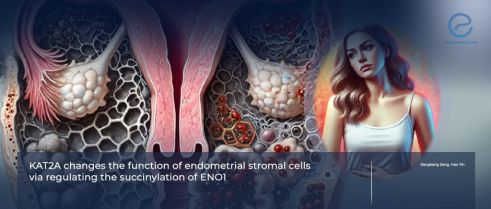 Endometrial Stromal Cell Function: The role of Histone acetyltransferase and Alpha-Enolase 