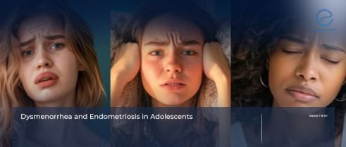 Endometriosis in Adolescents: Diagnosis, Treatment, and Challenges