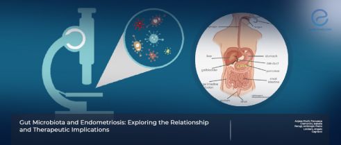 Gut Microbiota and Endometriosis; new kid on the block!