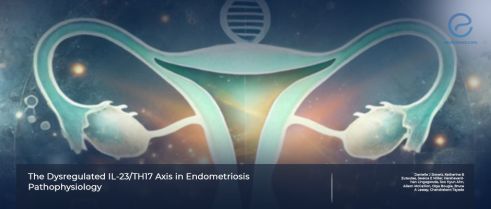 The Dysregulated IL-23/TH17 Axis in Endometriosis Pathophysiology