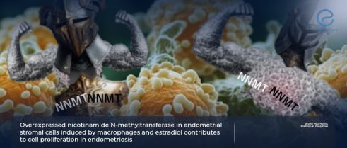 Exploring the Impact of NNMT Enzyme on Endometriosis