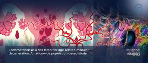 Linking Endometriosis to Age-Related Macular Degeneration