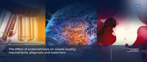Endometriosis-Related Infertility: Focus on Oocyte Quality