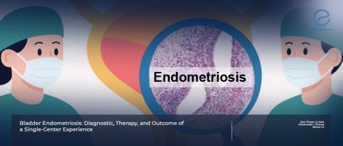 Symptom Improvement After Laparoscopic Treatment of Bladder Endometriosis