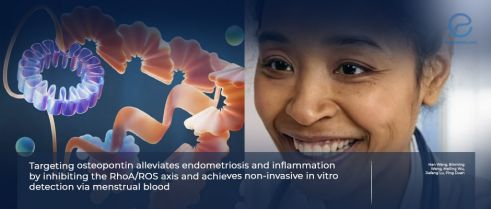 Targeting Osteopontin to Detect and Treat Endometriosis