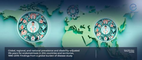 Thirty Years of Endometriosis Burden Across 204 Countries