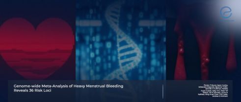 Heavy Menstrual Bleeding Shares Genetic Risk with Endometriosis and Fibroids