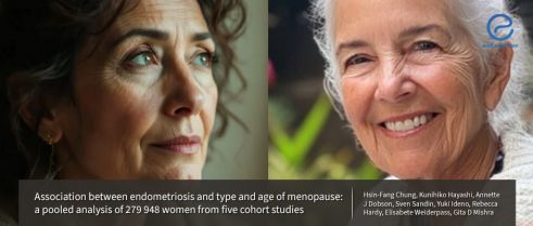 Surgical vs. Natural Menopause in Endometriosis