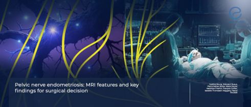 Pelvic nerve endometriosis: Diagnostic and treatment insights.