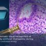 AI-Assisted Vision: Recognizing Endometriosis in Real Time