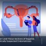 Reducing False Negatives in Endometriosis Histology Through Deeper Sections