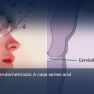 Study Sheds Light the Occurrence and Management of Cervical Endometriosis